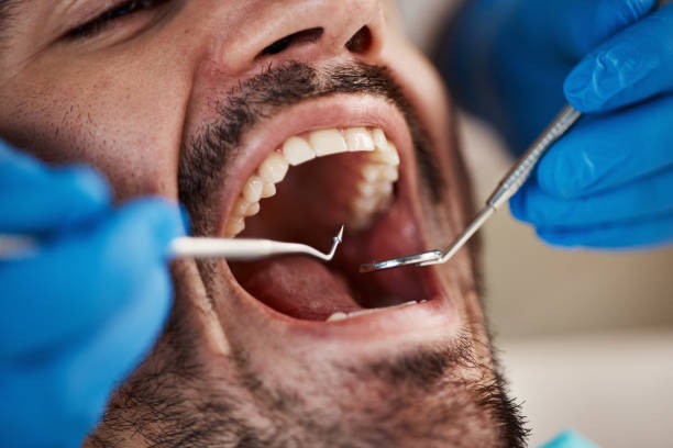 Best Weekend Emergency Dentist in Smithville Sanders, IN